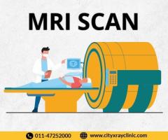 MRI Scan Near Me At Affordable Price In Delhi