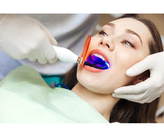 Dental Clinic | Bangalore | Best Dental Care | Discover Your Smile - Image 4