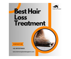 Best Hair Loss Treatment in Bangalore-Hair Transplants Treatment