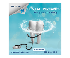 What are Dental Implants procedures ?