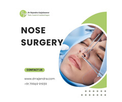 Best Rhinoplasty Surgeon in Bangalore | Nose Reshaping Surgery