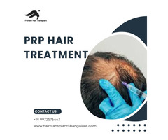 PRP Treatment Cost in Bangalore | PRP Hair Treatment