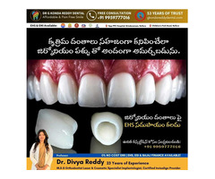 Achieve a Beautiful Smile with Zirconia Teeth at Dr. G Konda Reddy Dental