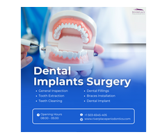 What is Dental Implants Surgery ?