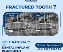 Endodontist at jai Jinendra Dental Hospital - Image 3