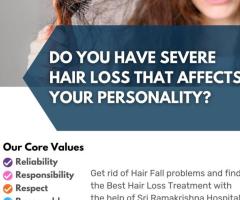 Hair Loss Treatment in Coimbatore - Sri Ramakrishna Hospital - Image 1