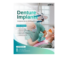 What Are Denture Implants?