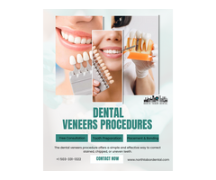 Are Denture Veneers Permanent or Removable?