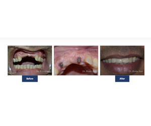 Cosmetic Dentistry Mumbai - Image 2