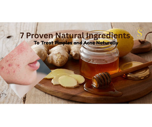 7 Proven Natural Ingredients to Treat Pimples and Acne Naturally