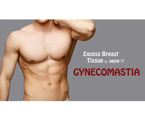 Best Gynecomastia Surgery in Bangalore for Permanent Results