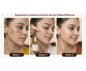 Best Treatment for Pigmentation on Face at Home
