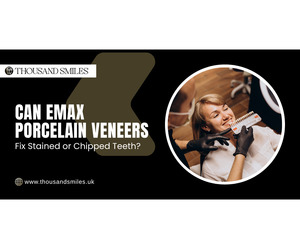 Can Emax Porcelain Veneers Fix Stained or Chipped Teeth?