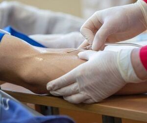 Anti Aging IV Therapy: Boost Energy, Skin & Wellness