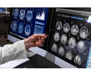 Need a Private MRI Scan? Discover Fast & Reliable Imaging at Marris Medical UK