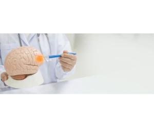 Brain Cancer Treatment in Delhi