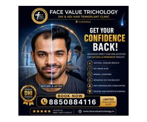 Transform Hair Loss Into Confidence with Advanced DHI Hair Transplant