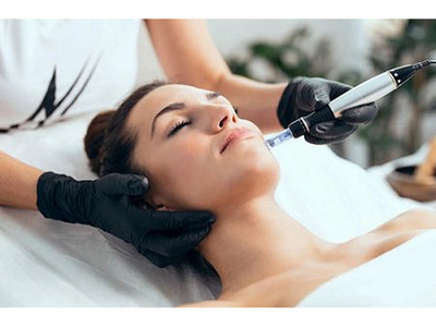 Microneedling Tampa for Healthy and Radiant Skin