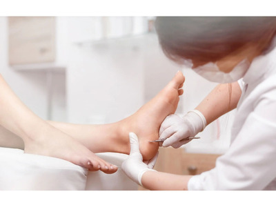 Treatment of Fungal Toenail Calgary