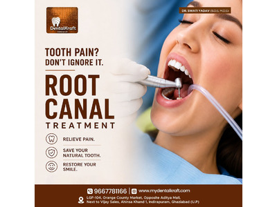 Best RCT Clinic in Indirapuram for Painless Treatment