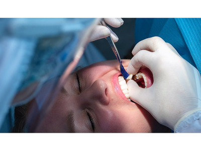 Dental bonding Peoria, AZ