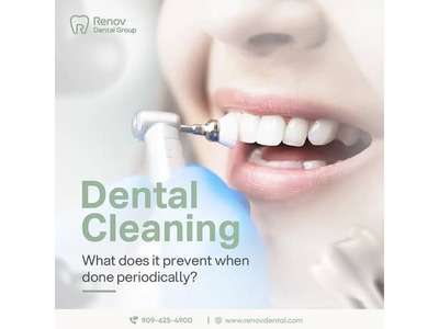 Teeth Whitening in Claremont