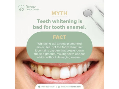 Dental Fillings in Claremont