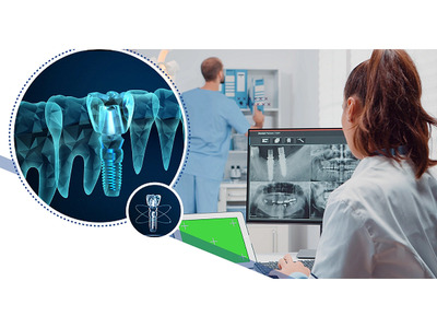 Teeth Implant Bridges Service provider Whittier
