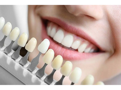 Dental Examinations in Palo Alto