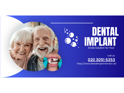 Trusted Dental Implants London Clinic – Book Today!