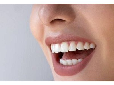 Tooth Colored Fillings Mount Roskill