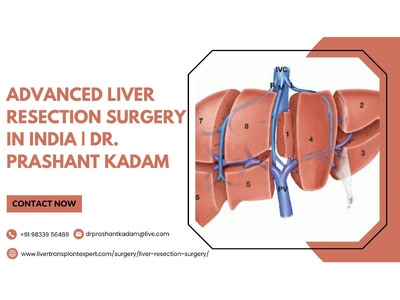 Advanced Liver Resection Surgery in India | Dr. Prashant Kadam