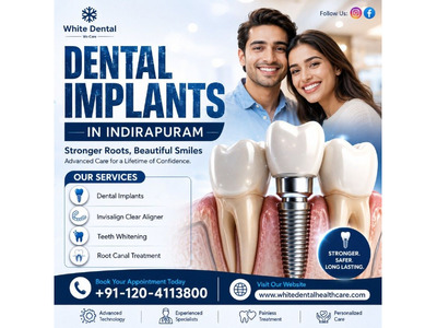 Dental Implants in Indirapuram | Best Implant Dentist Ghaziabad