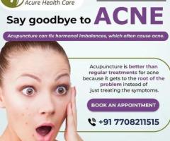Acupuncture Treatment in Chennai - Best Acupuncturist Near Me - Chetpet and Annanagar - Image 4